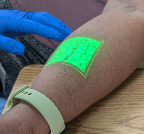 Arm with a green laser projection on it showing the path of veins.