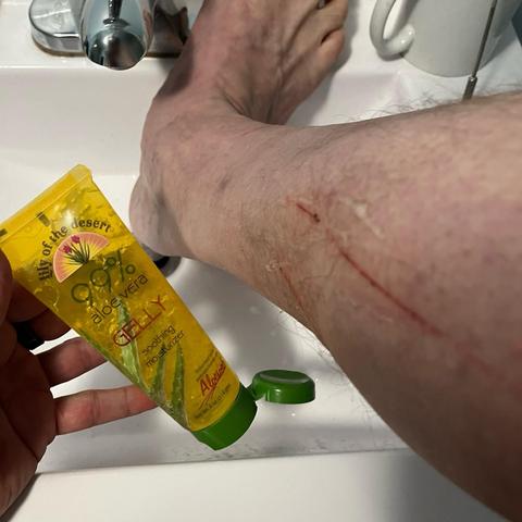 My foot in a sink, showing red cat scratches and a container of aloe vera gel. There is a small cat reflection in the faucet chrome