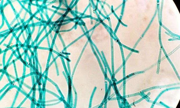 An image of Cyanobacteria, Tolypothrix. Credit: Wikipedia / CC BY-SA 3.0 

"We can't break down sucralose, and a lot of microorganisms can't break it down, either, because it's a really tough molecule that doesn't degrade easily. So there are a lot of questions about how it is affecting the environment and whether it's something that could impact our microbial communities."