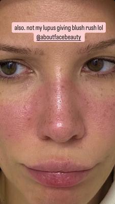 Captura stories Instagram. Primer plano de Halsey más cercano sin la mariposa. 'Also. Not my lupus giving blush rush lol (y su mstca de cosmética)'