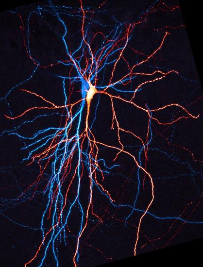 With M. Letellier, confocal microscopy