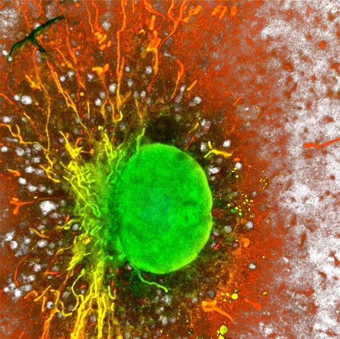 With J. Garaude, expanded macrophage