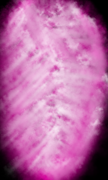 A brain having grand mal seizure