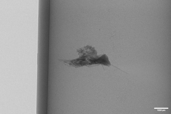 Projection image from a tomograpic scan of a small spider.