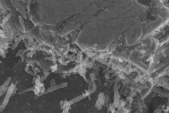 a photo of bacteria. it isn't clear if this is the bacteria that colonized the asteroid sample, or a stock photo.