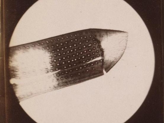 Shell of an insect, magnified 25 times
