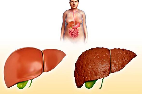 Best liver transplant surgeon in Kochi
