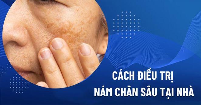 Cách trị nám chân sâu