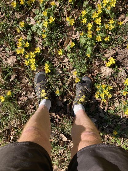 Die Beine mit kurzer Hose und Laufschuhe von oben fotografiert die in WInterlingen stehen.