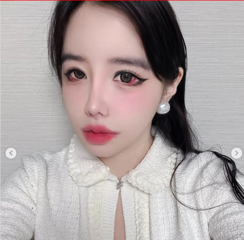 This contain an image of  This contain an image of  Park  Bom’s bloodshot eyes selfie situation