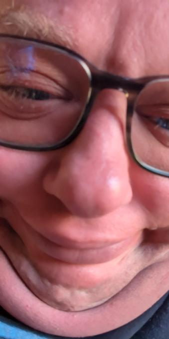 Butterball face returns!