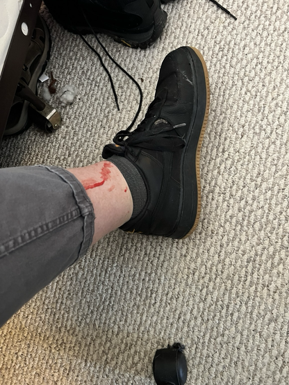 A man’s ankle with blood peeking out the pants cuff. I’m okay! 