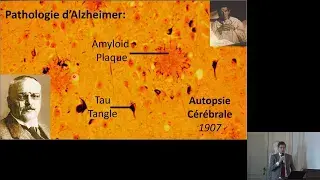 Alzheimer et Bernard Hanseeuw