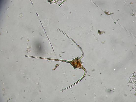 Microorganismo con tres "cuernos", uno longitudinal y dos en el polo opuesto que se curvan simétricamente, alejando los extremos entre sí.