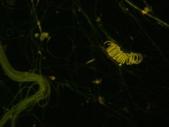 10x objective 12.5x camera 460nm epi fluorescence