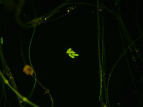 25x ThT 460nm epi #fluorescence .