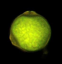 40x obj / 12.5x cam TfT stain 460nm Pollen