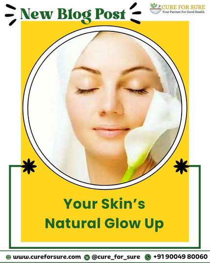✨ Say Goodbye to Acne Naturally! ✨

🔗 Want more Ayurvedic skincare secrets?

📌 Read More: https://cureforsure.com/blog/2024/08/03/your-skins-natural-glow-up/
📸 Follow us on Instagram: @cure_for_sure
📞 Contact: +91 9004980060

#NaturalGlow #AcneFree #ClearSkin #AyurvedaBeauty #HealthySkin #HolisticHealing #TeaTreeOil #SkinCareTips #SelfCareRoutine #TurmericMagic #GlowUp #GreenTeaBenefits #WitchHazel #NaturalRemedies #CureForSure