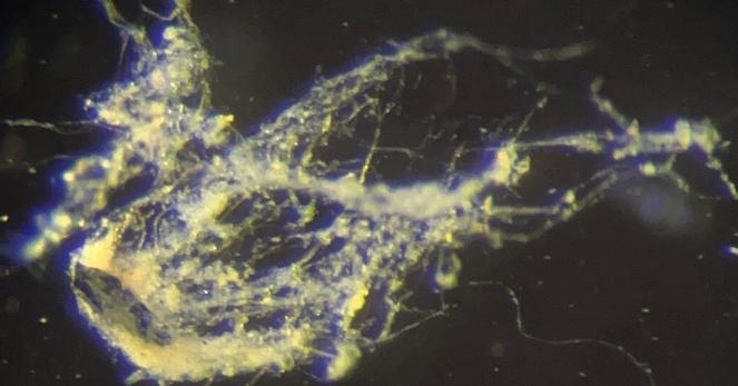 Scientists Find New Bacteria That Act Like Living Wires