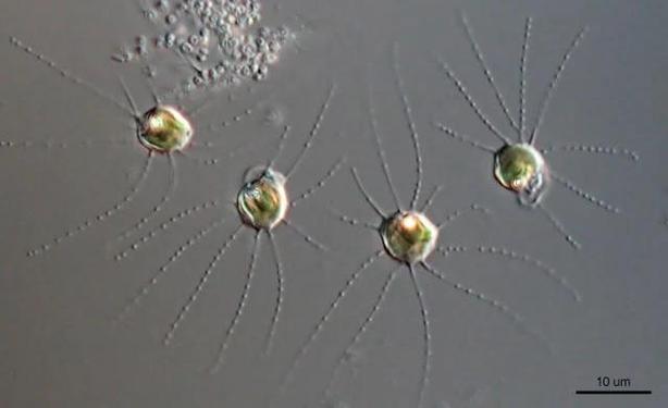 Imagen de microscopio de unos microorganismos redondos con largos filamentos a cada lado con "cuentas", como un collar.