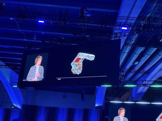 A photo of a shaggy guy in a flannel shirt showing what looks like a retainer with a pad at the roof of the mouth and wires and electronics embedded in it 