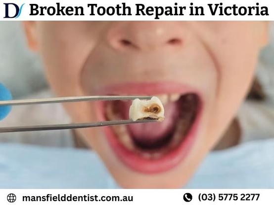 Broken Tooth Repair in Victoria - Delatite Dental Mansfield Dentist