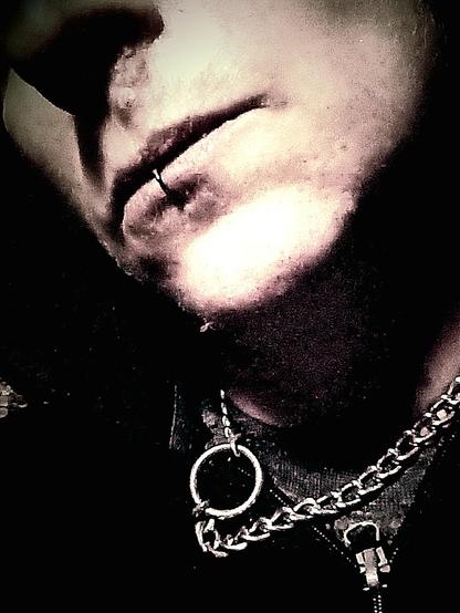 photo of the bottom half of my face, with a massive coldsore under my right nostril. you can see i'm wearing a stainless steel dog choker and i have a piercing ring through the middle of my bottom lip. photo is edited in black & white