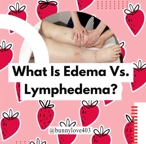 What Is Edema Vs. Lymphedema?