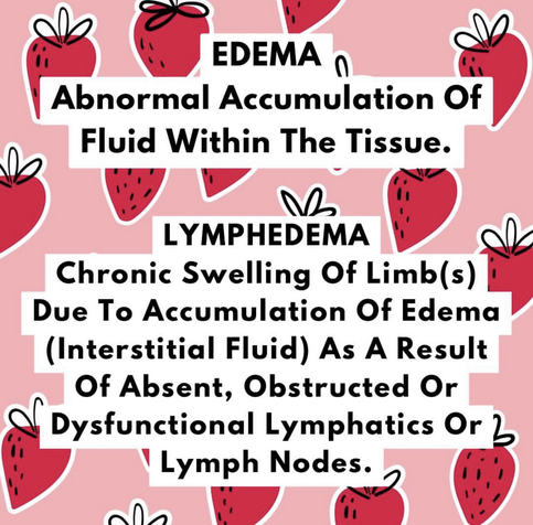 EDEMA Abnormal Accumulation Of Fluid Within The Tissue. LYMPHEDEMA Chronic Swelling Of Limb(s) Due To Accumulation Of Edema (Interstitial Fluid) As A Result Of Absent, Obstructed Or • Dysfunctional Lymphatics Or Lymph Nodes. 