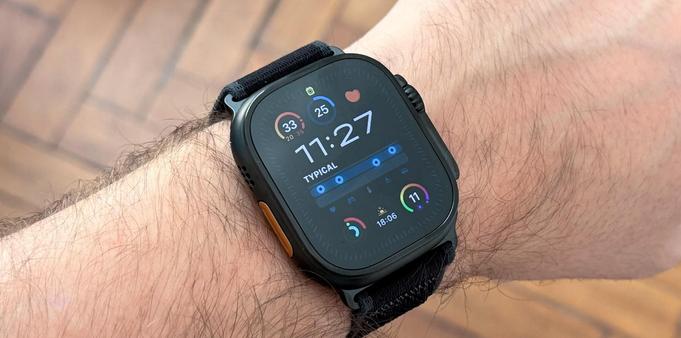 Explore New Apple Watch Features in the watchOS 11.5 Update.