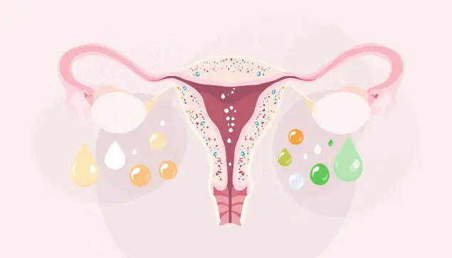 Abstract medical illustration of a simplified female reproductive system with colorful droplets representing various vaginal discharge colors on a pastel background.