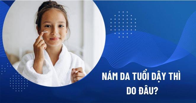 nám da tuổi dậy thì