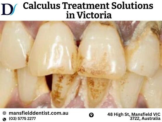 Calculus Treatment solutions in victoria