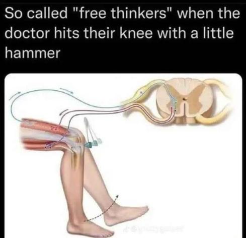 so called "free thinkers" when the doctor hits their knee with a little hammer

[picture of hitting the knee with a hammer and it kicking]