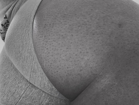 Wanna Kiss It?