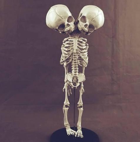 Photo of a creation made by Etsy user My Wife’s Thousand Faces. It is categorised as “Double-Headed Anatomy Skeletal Model Fetus, Skeleton, Skull, Bizarre, Cabinet of Curiosities”.