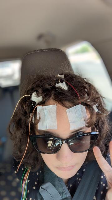 A selfie of Ivy in sunglasses, giving a peace sign. She has medical leads taped and glued to her scalp from her forehead and throughout her head, unable to tame her curly haired mane