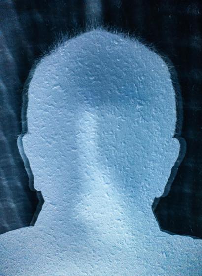 A blue-tinted negative photograph of the silhouette of my head, cast on a flocked wallpaper wall. You can see my ears and my short hair sticking out, especially at the top of my almost bald head. There are two silhouettes superimposed as there are two light sources. The silhouette of my head is a lighter grey-blue while the illuminated background is dark. There’s a lighter patch in the middle of my head which is me holding my mobile phone for the photo.