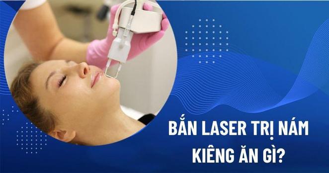 bắn laser trị nám
