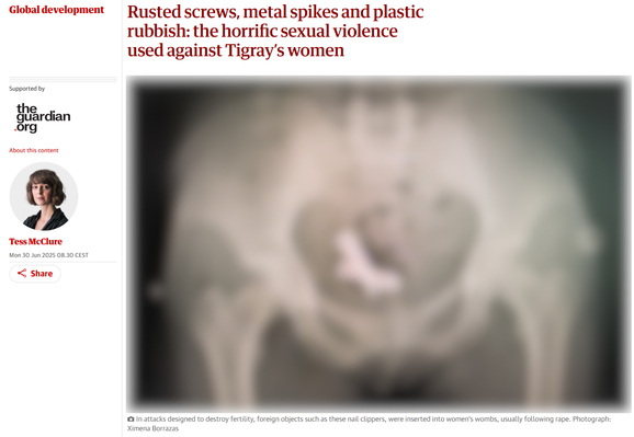 The image is a screenshot of a news article from The Guardian. The headline reads, "Rusted screws, metal spikes and plastic rubbish: the horrific sexual violence used against Tigray's women." The article is dated Monday, June 30, 2025, and is written by Tess McClure. The image in the article is blurred, but it appears to show a medical X-ray or scan of a pelvic area, with a foreign object visible. The caption below the image states, "In attacks designed to destroy fertility, foreign objects such as these nail clippers were inserted into women's wombs, usually following rape. Photograph: Ximena Borrazas." The overall tone of the image and text is serious and informative, focusing on the topic of sexual violence against women in Tigray.