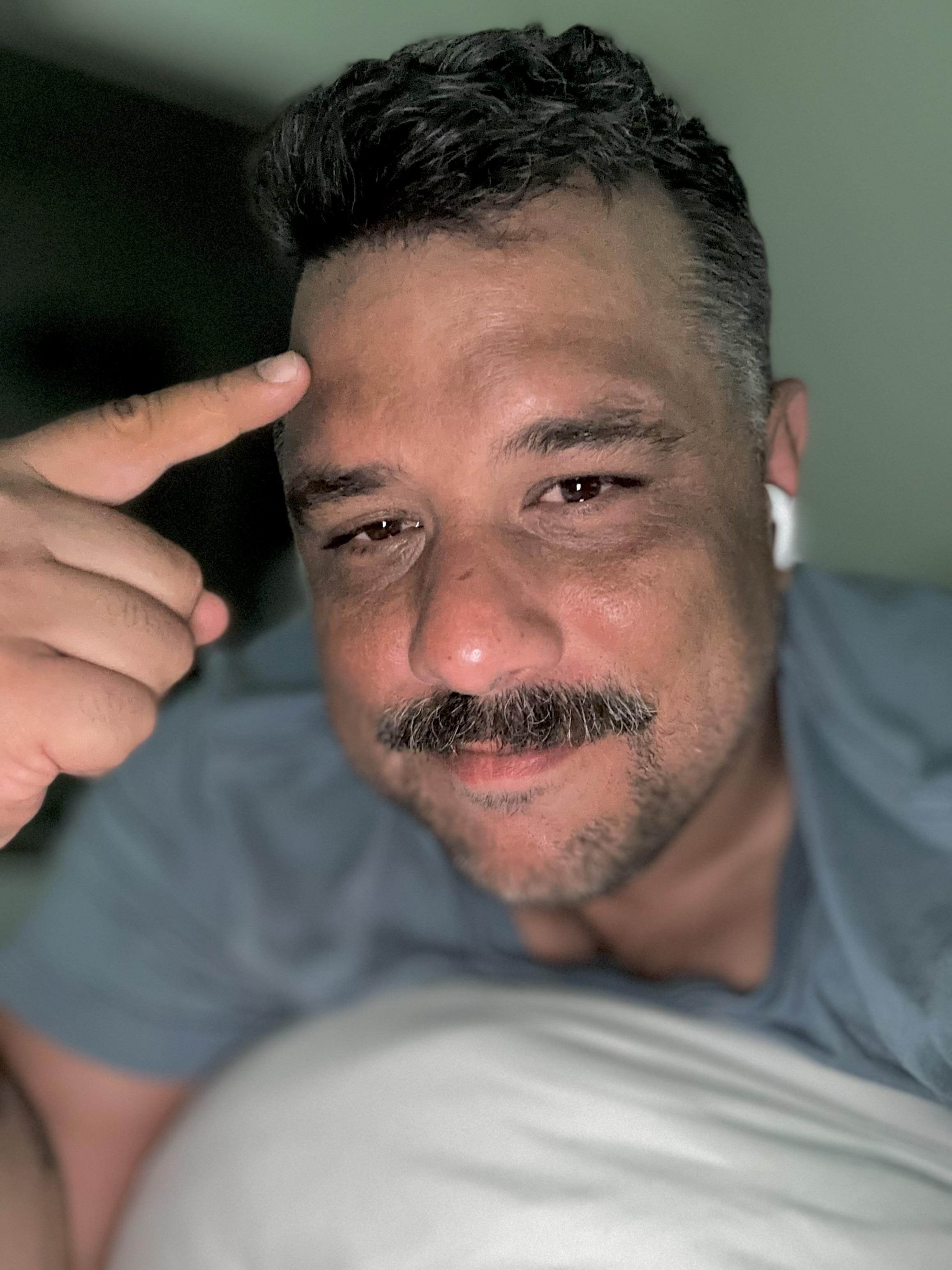 Me pointing to my forehead that is three shades lighter than the rest of my face. 