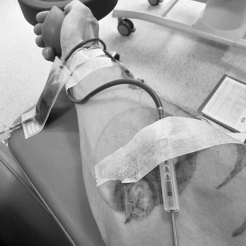 Close-up van een arm tijdens een bloeddonatie, met een naald, een slangetje voor de bloedafname en een knijpbal in de hand.