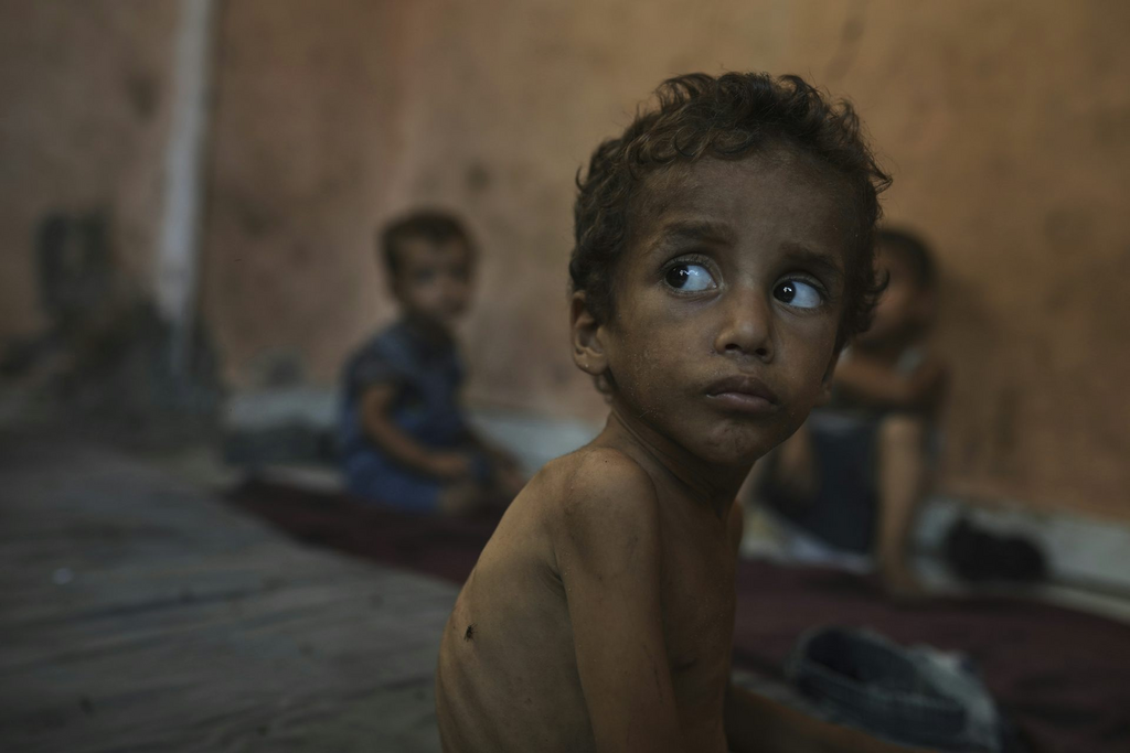Yazan Abu Ful, a 2-year-old malnourished child, sitting in the Shati refugee camp in Gaza City on July 23, 2025