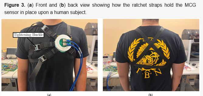 Caption: "Figure 3: (a) Front and (b) back view showing how the ratcht snaps hold the MCG sensor in place upon a human subject".

In both pictures there is a probably male person with the image cut off at the neck and a black t-shirt with their arms held by their side and what looks like a workstation in an electronics lab with maybe a 3-d print on the left side.  In (a) five straps converge on a big white circle with a  green center and two thick blue wires running down from the person's chest…