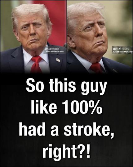 Something seems off with Trump in these latest pics. Is he dealing with a stroke or another hidden health issue? Either way, why the cover-up?

#BlueCrew #TrumpHealth #TrumpLiesMatter #Resist #DefendDemocracy