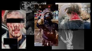 
StreetPress a analysé 59 situations de violences illégitimes.