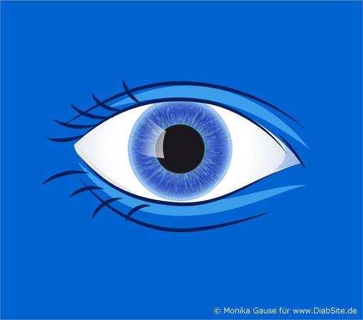 Diabetes und Auge.