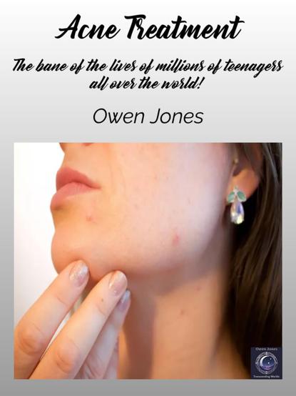 Acne Treatment book cover