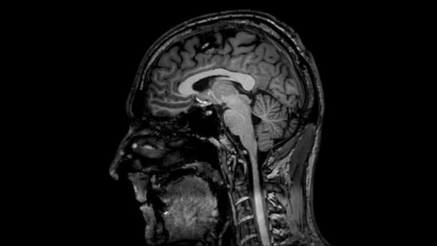 Mon cerveau en IRM, en 2014, pour dépanner une étudiante
