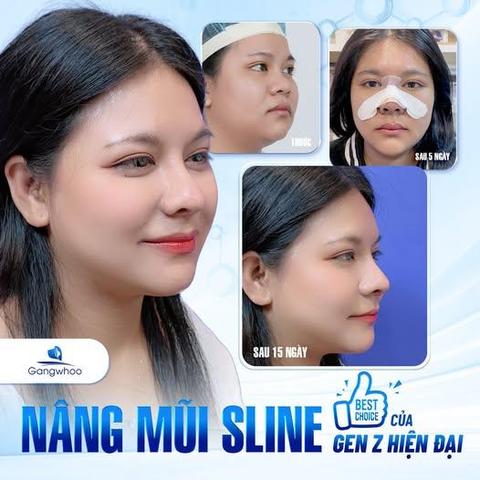 các dáng mũi nâng